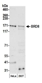 Rabbit anti-BRD8 Antibody, Affinity Purified