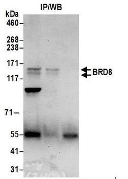 Rabbit anti-BRD8 Antibody, Affinity Purified