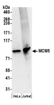 Rabbit anti-MCM5 Antibody, Affinity Purified