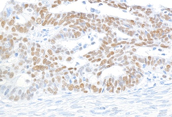 Rabbit anti-MCM2 Antibody, Affinity Purified