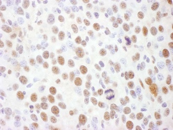 Rabbit anti-Phospho Rad17 (S645) Antibody, Affinity Purified
