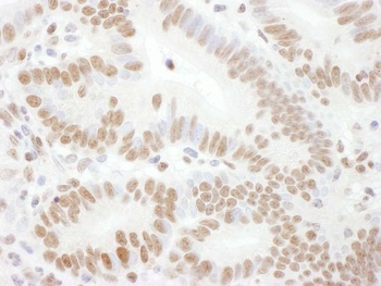 Rabbit anti-Phospho Rad17 (S645) Antibody, Affinity Purified