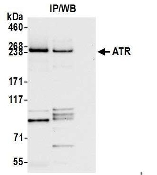 Rabbit anti-ATR Antibody, Affinity Purified