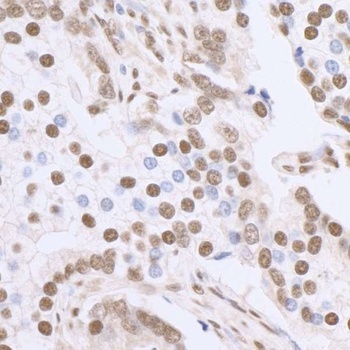 Rabbit anti-Sp1 Antibody, Affinity Purified