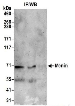 Rabbit anti-Menin Antibody, Affinity Purified
