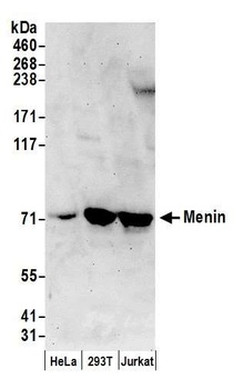 Rabbit anti-Menin Antibody, Affinity Purified
