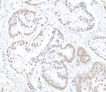 Rabbit anti-RbBP5 Antibody, Affinity Purified