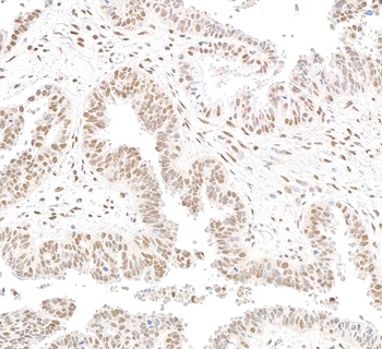 Rabbit anti-RbBP5 Antibody, Affinity Purified