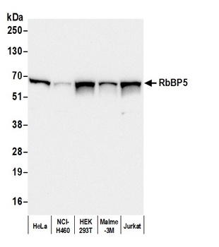 Rabbit anti-RbBP5 Antibody, Affinity Purified