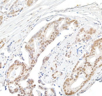 Rabbit anti-Menin Antibody, Affinity Purified