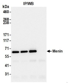 Rabbit anti-Menin Antibody, Affinity Purified