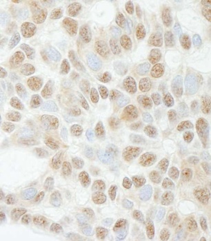Rabbit anti-ADNP Antibody, Affinity Purified