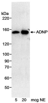 Rabbit anti-ADNP Antibody, Affinity Purified