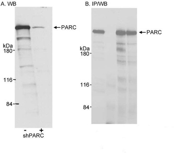 Rabbit anti-PARC/H7-AP1 Antibody, Affinity Purified