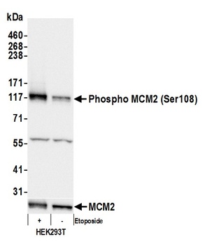 Rabbit anti-Phospho MCM2 (S108) Antibody, Affinity Purified