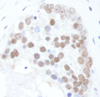 Rabbit anti-Phospho XRCC1 (S518/T519/T523) Antibody, Affinity Purified