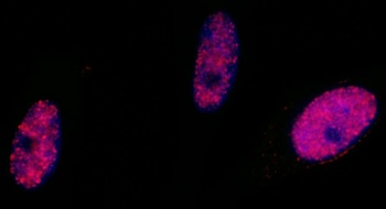 Rabbit anti-Phospho SMC1 (S966) Antibody, Affinity Purified