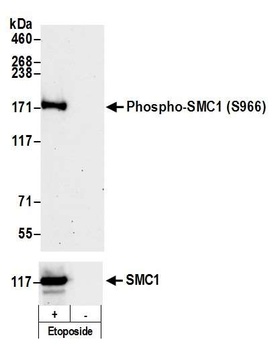 Rabbit anti-Phospho SMC1 (S966) Antibody, Affinity Purified