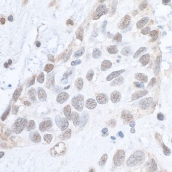 Rabbit anti-Phospho SMC1 (S966) Antibody, Affinity Purified