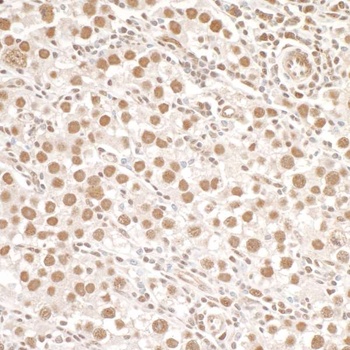 Rabbit anti-Phospho SMC1 (S966) Antibody, Affinity Purified