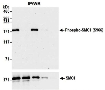 Rabbit anti-Phospho SMC1 (S966) Antibody, Affinity Purified