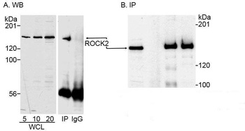 Rabbit anti-ROCK2 Antibody, Affinity Purified