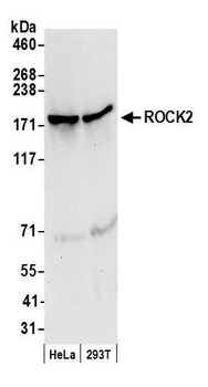 Rabbit anti-ROCK2 Antibody, Affinity Purified