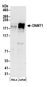 Rabbit anti-DNMT1 Antibody, Affinity Purified