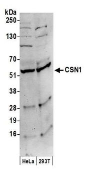 Rabbit anti-CSN1 Antibody, Affinity Purified