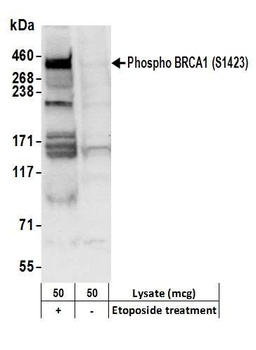Rabbit anti-Phospho BRCA1 (S1423) Antibody, Affinity Purified