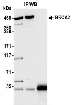 Rabbit anti-BRCA2 Antibody, Affinity Purified