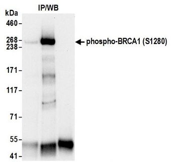 Rabbit anti-Phospho BRCA1 (S1280) Antibody, Affinity Purified
