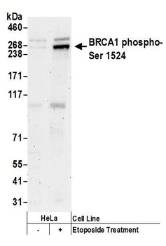 Rabbit anti-Phospho BRCA1 (S1524) Antibody, Affinity Purified