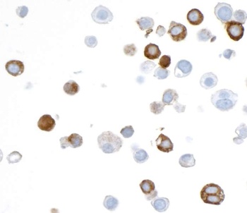 Rabbit anti-V5 Tag Recombinant Monoclonal Antibody [BLRE03H]