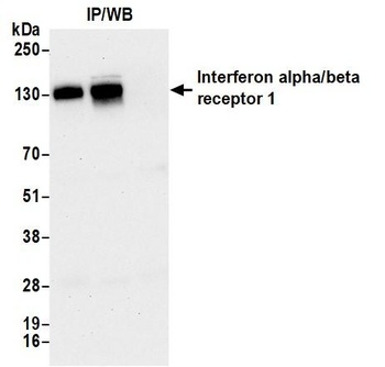Rabbit anti-Interferon alpha/ beta receptor 1 Recombinant Monoclonal Antibody [BLR265L]