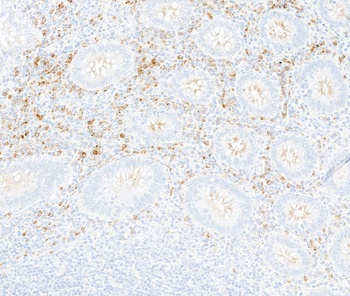 Rabbit anti-Interferon alpha/ beta receptor 1 Recombinant Monoclonal Antibody [BLR265L]