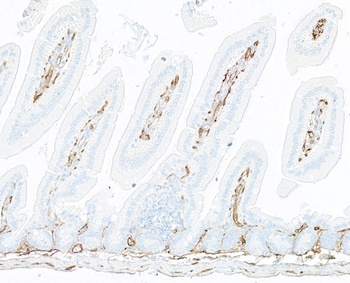 Rabbit anti-Thrombomodulin Recombinant Monoclonal Antibody [BLR260L]