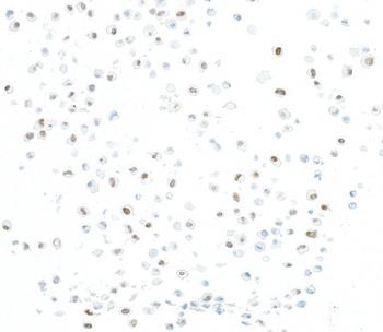 Rabbit anti-JMJD6 Recombinant Monoclonal Antibody [BLR254L]