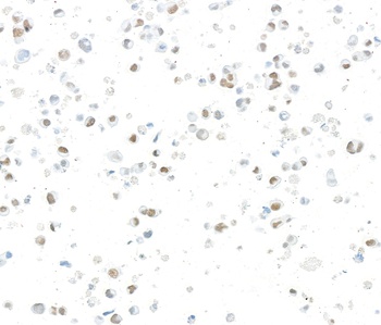 Rabbit anti-JMJD6 Recombinant Monoclonal Antibody [BLR254L]