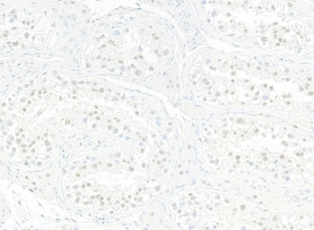 Rabbit anti-JMJD6 Recombinant Monoclonal Antibody [BLR254L]