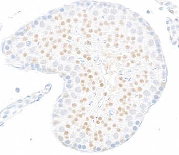 Rabbit anti-JMJD6 Recombinant Monoclonal Antibody [BLR254L]