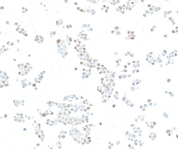 Rabbit anti-KLF4 Recombinant Monoclonal Antibody [BLR250L]