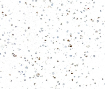 Rabbit anti-INSM1 Recombinant Monoclonal Antibody [BLR272L]