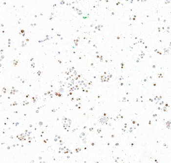 Rabbit anti-INSM1 Recombinant Monoclonal Antibody [BLR272L]