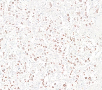 Rabbit anti-INSM1 Recombinant Monoclonal Antibody [BLR272L]