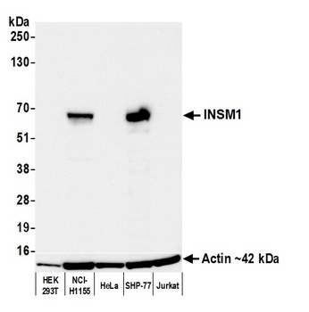Rabbit anti-INSM1 Recombinant Monoclonal Antibody [BLR272L]