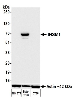 Rabbit anti-INSM1 Recombinant Monoclonal Antibody [BLR272L]