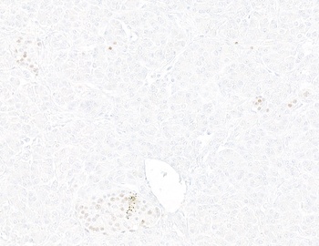 Rabbit anti-INSM1 Recombinant Monoclonal Antibody [BLR272L]