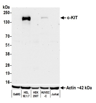 Rabbit anti-c-Kit Recombinant Monoclonal Antibody [BLR263L]