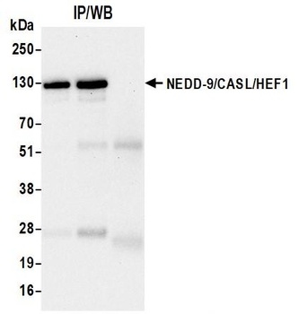 Rabbit anti-NEDD-9/CASL/HEF1 Recombinant Monoclonal Antibody [BLR248L]